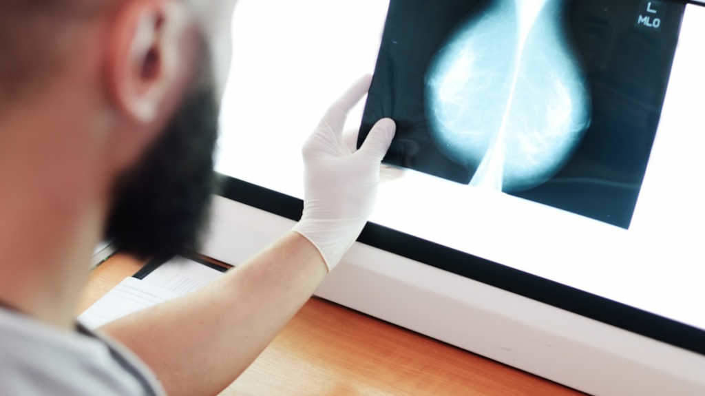 Imaxe posterior a unha mamografía (Foto: Hospital la Luz).