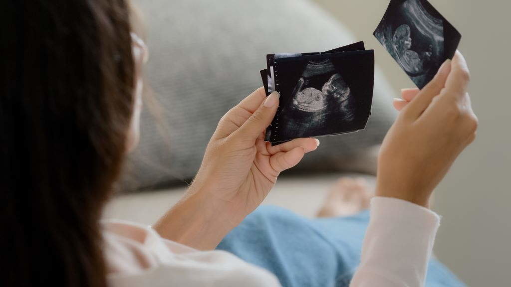 A estatística apunta que un de cada catro embarazos acaba en aborto ou morte fetal. (Foto: Nós Diario).