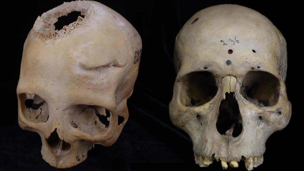 Cranios analizados polo equipo investigador liderado pola USC (Foto: USC).