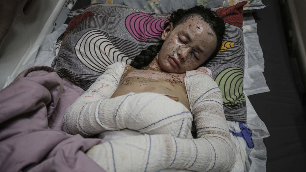 Crianza palestina ferida nun ataque israelí a Gaza, onte. (Foto: Omar Ashtawy / APA Images via ZUMA / DPA vía Europa Press)