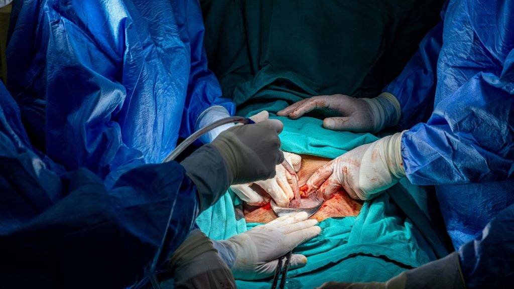Procedemento médico durante a realización dunha cesárea. (Foto: Nós Diario).